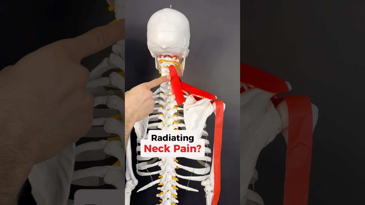 Radiating Neck Pain? Fix the Muscles under it all! #scalenes #neckpain #shoulderpain #armpain #neck