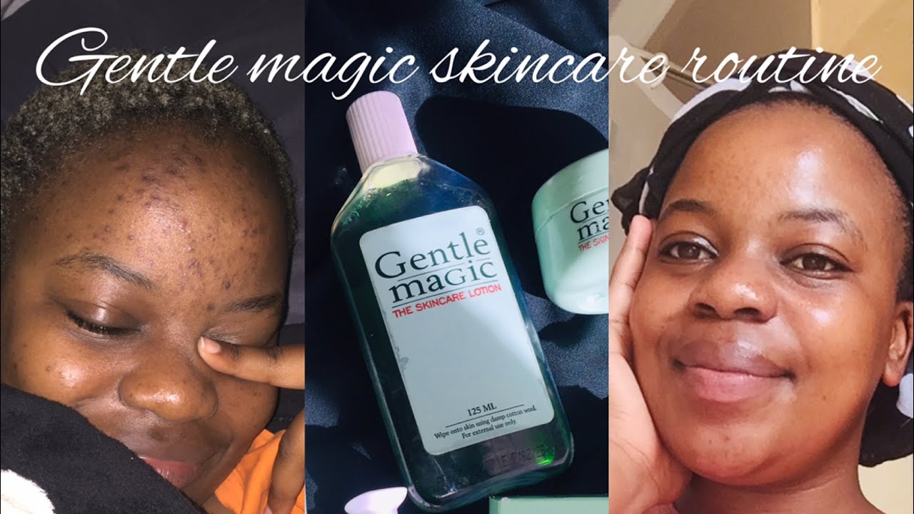 Affordable skincare routine for acne ft Gentle magic|Acne free|South African youtuber