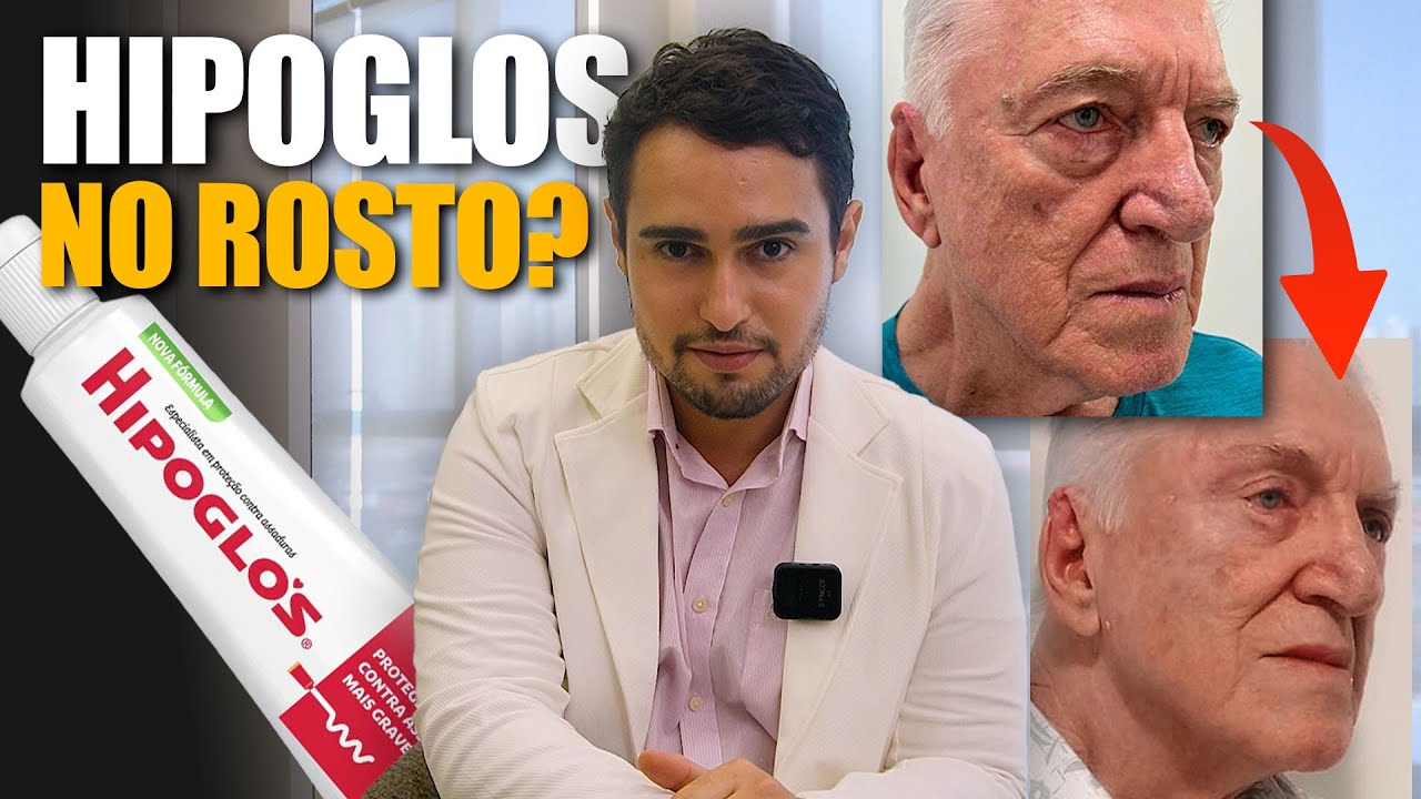 HIPOGLOS NO ROSTO FUNCIONA? ENTENDA