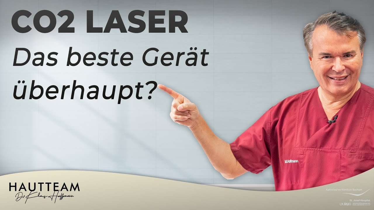 CO2 Laser -Warum ist er so beliebt?