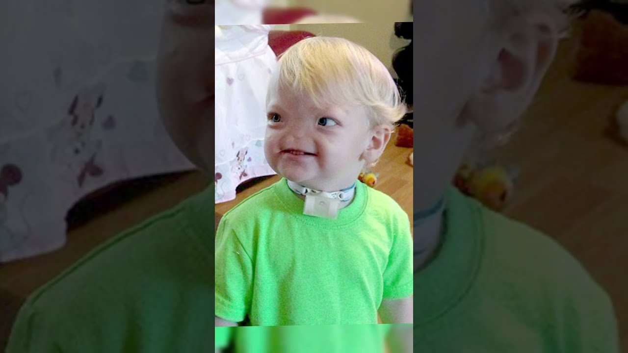 AS PESSOAS MAIS RARAS DO MUNDO! PT.1 😮🤗 #shorts #youtubeshorts #youtube