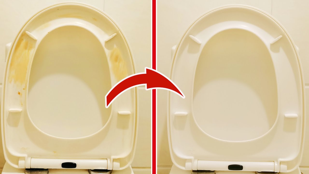 Всего одно небольшое действие - и сиденье вашего унитаза снова станет белым и чистым!💥(нужно знать)🤯