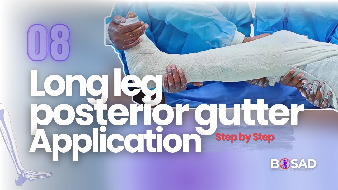 Lesson 08: Long Leg Posterior Gutter Application | ከጉልበት በላይ የኋላ መደገፊያ ጀሶ አሰራር | Step-by-Step Guide.