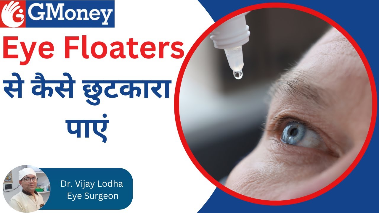आंखों के सामने काले धब्बे (Eye Floaters ka sahi ilaj) - GMoney Health Show