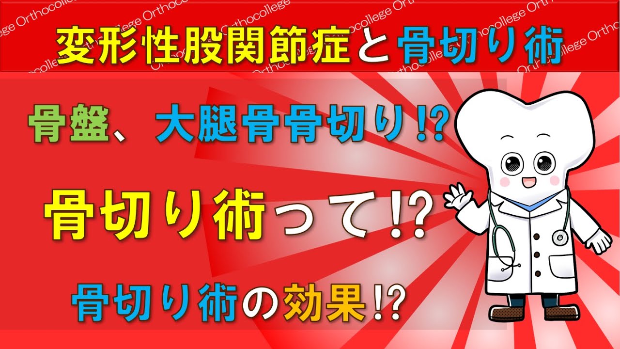 変形性股関節症と骨切り術 骨切り術って⁉ 骨切り術の効果は⁉ 【医師が解説】