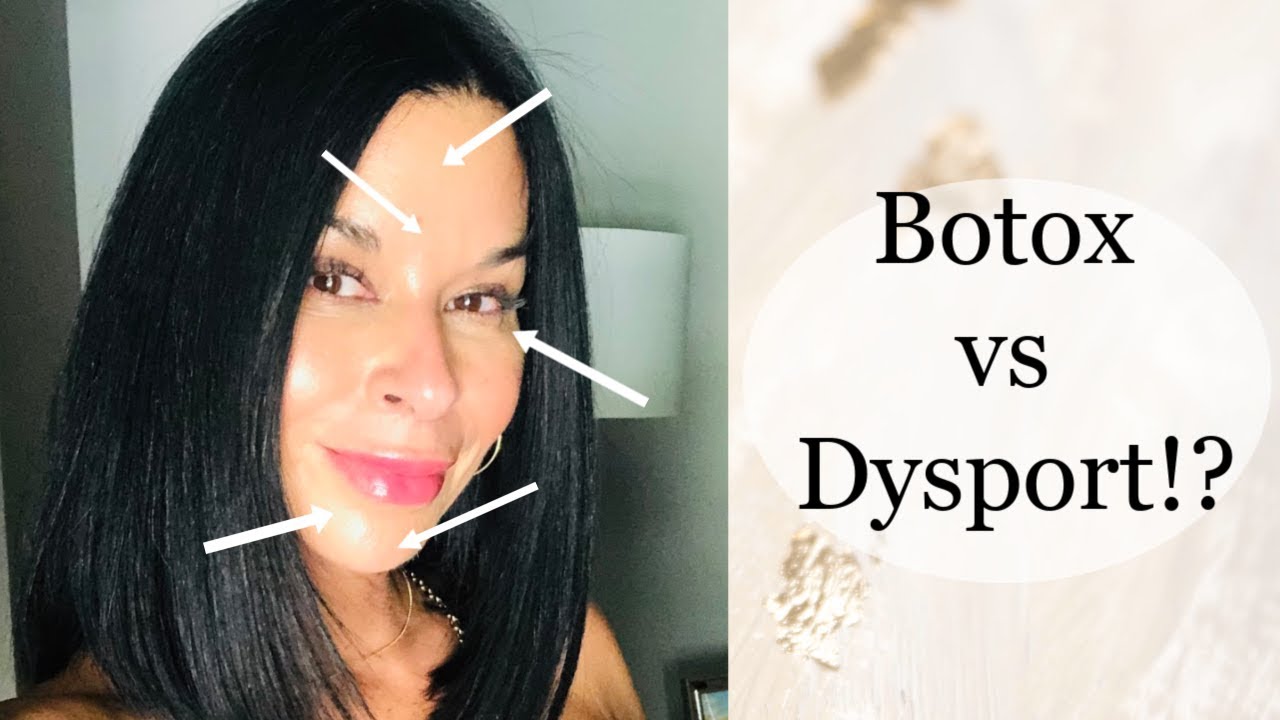 MY EXPERIENCE WITH BOTOX & DYSPORT