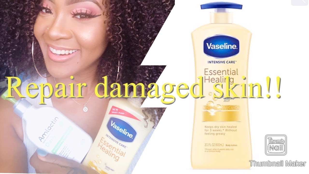 I ruined my skin with steroid cream #glutathione #skinlightening #naturalskinlightening