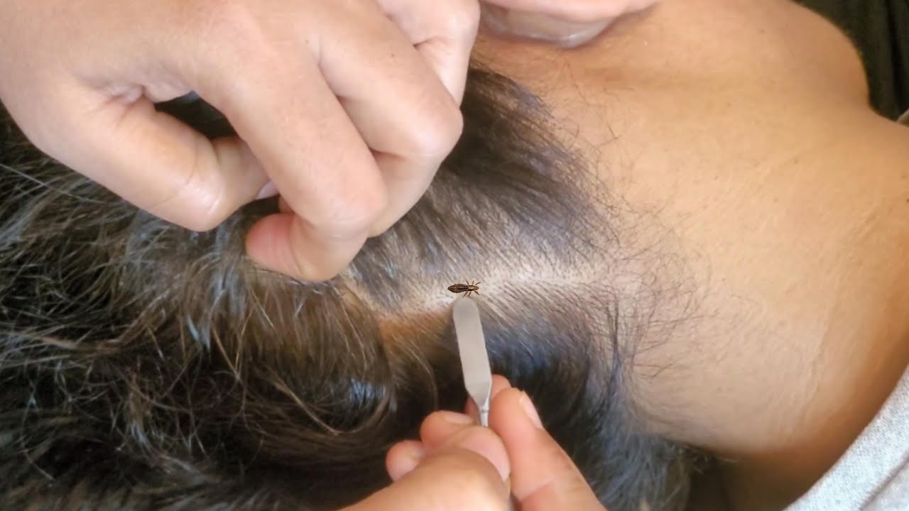 Scalp Check & Tingles: The Science of ASMR