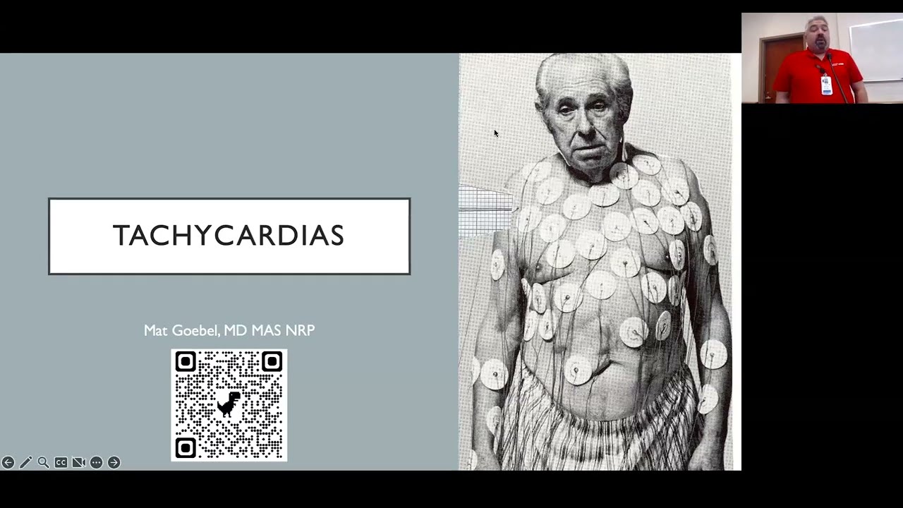 Tachycardias