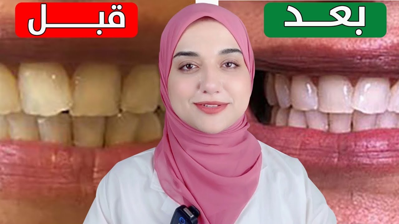 افضل وصفة على الاطلاق لتبييض الاسنان والتخلص من الجير والتكلسات بمكون طبيعى واحد