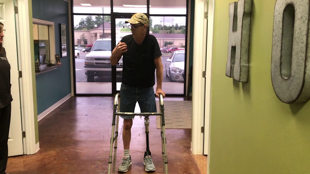 Amputee up Walking | New Hope Prosthetics