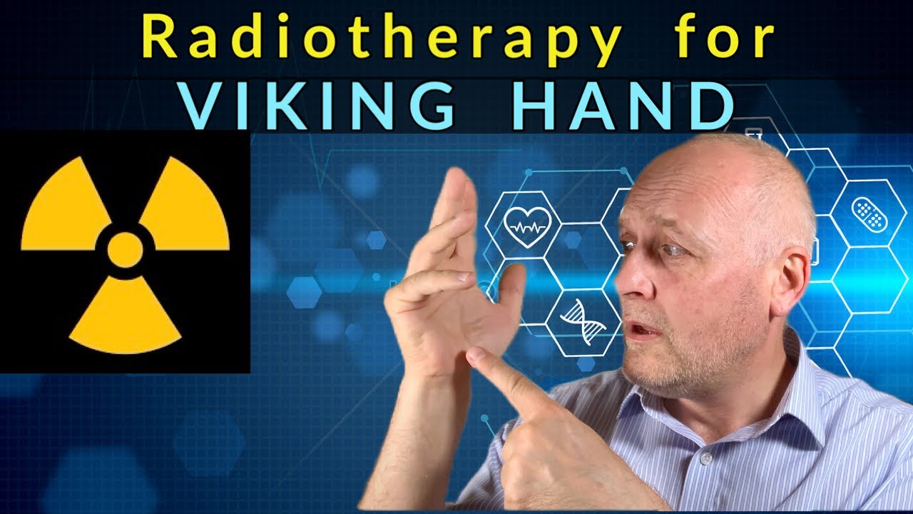 Radiotherapy for Dupuytren's Contracture / Viking Hand. The Pros and Cons.