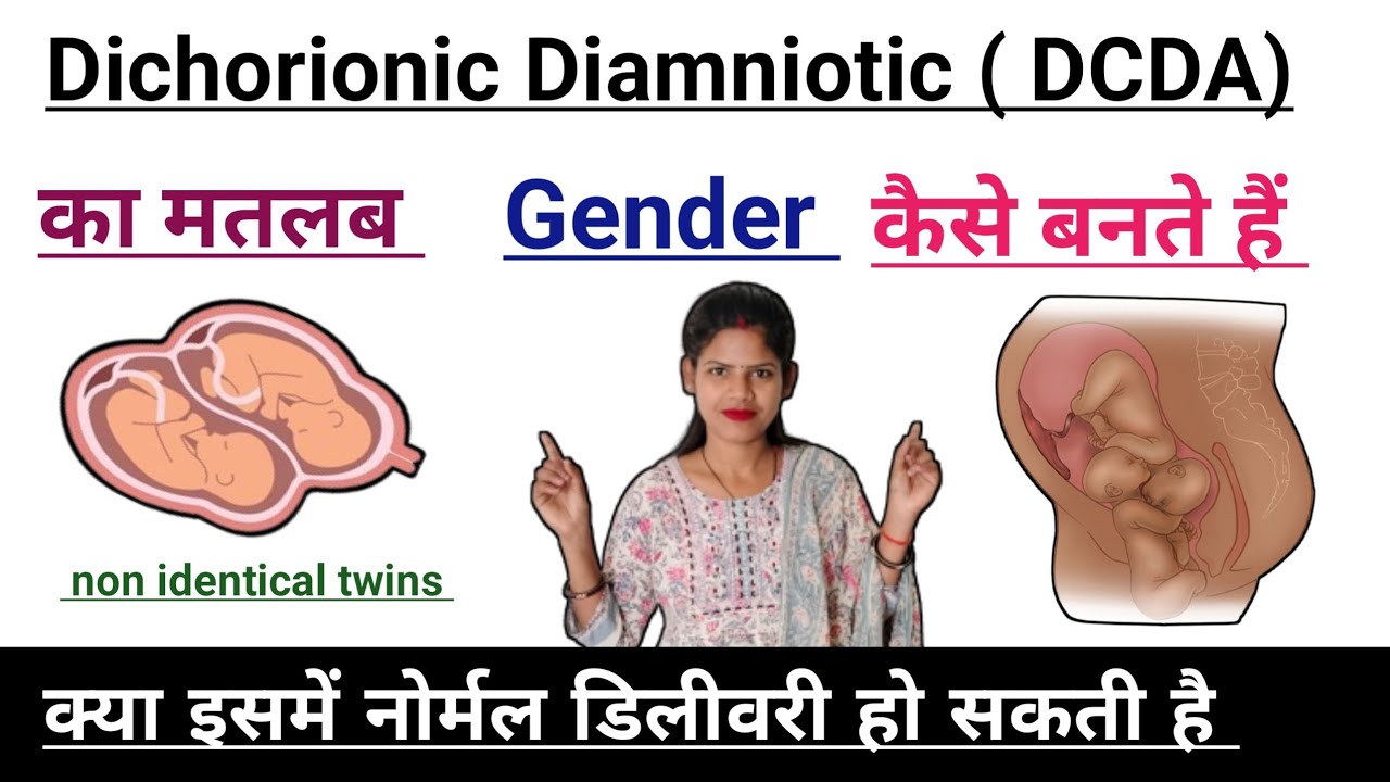 Dichorionic Diamniotic twins pregnancy me normal delivery ho sakti hai ya nhi Dcda twins pregnancy
