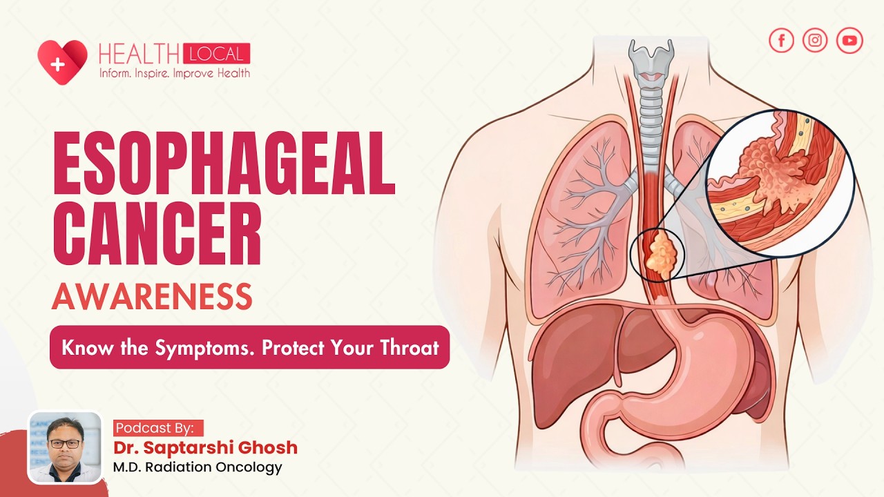 Esophageal Cancer | Dr. Saptarshi Ghosh x Health Local India