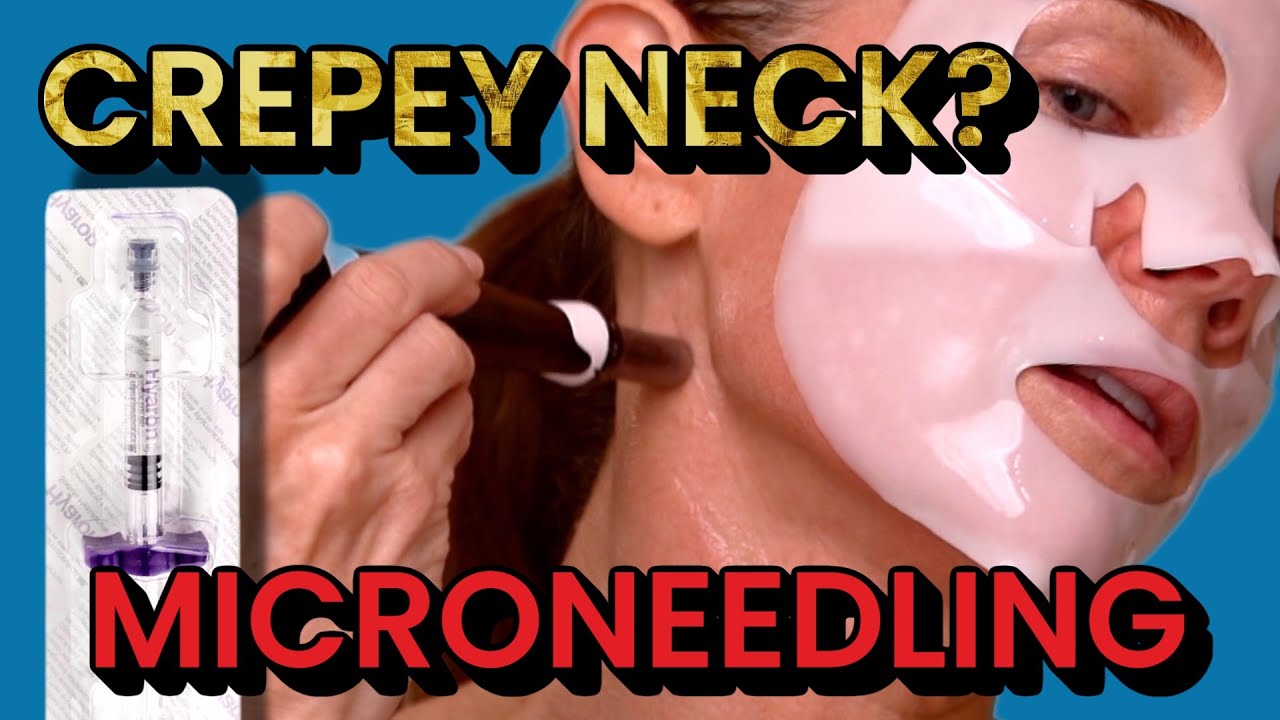 Erase Crepey Neck Skin? LIVE Microneedling Neck with Dr. Pen A6 + Hyaron