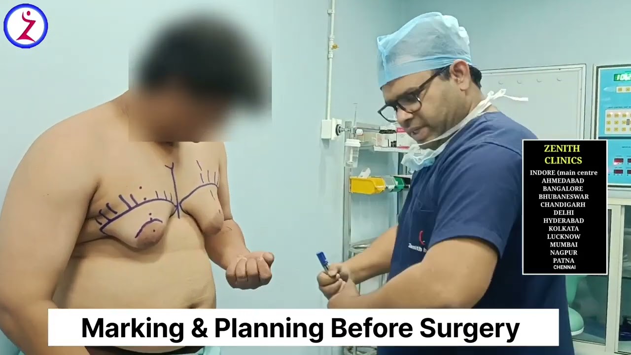 Gynecomastia In Ahmedabad | Gynecomastia Surgery Cost In Ahmedabad |  Zenith Clinic