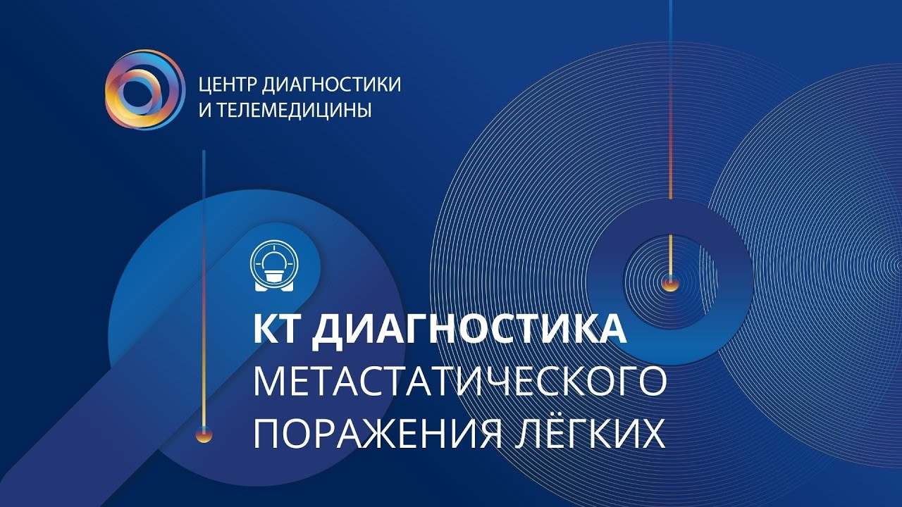 КТ диагностика метастатического поражения лёгких