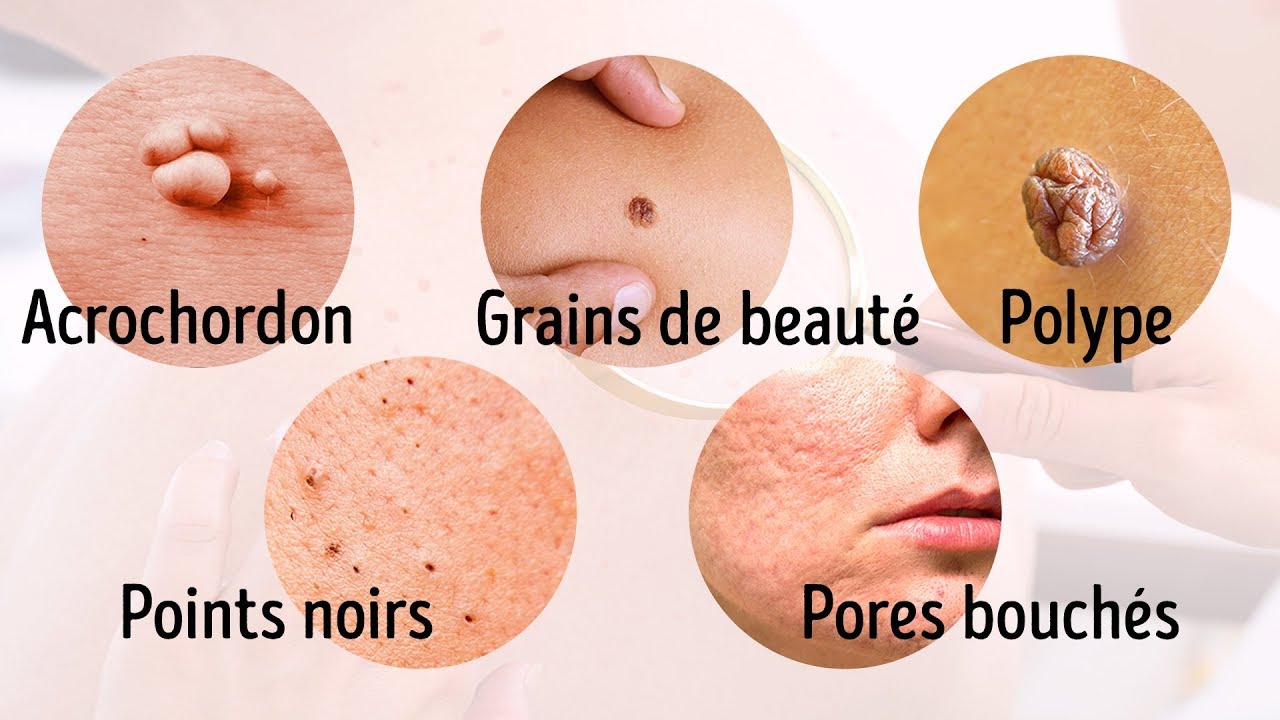 8 Maladies Graves Que Notre Peau Nous Signale
