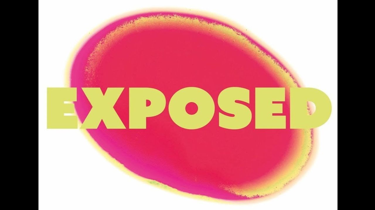 Exposed Closing Set - lefskiii