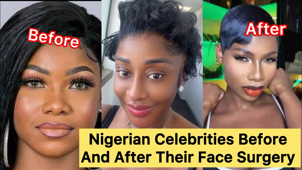 8 Nigerian Celebrities Before And After Their Face Surgery: