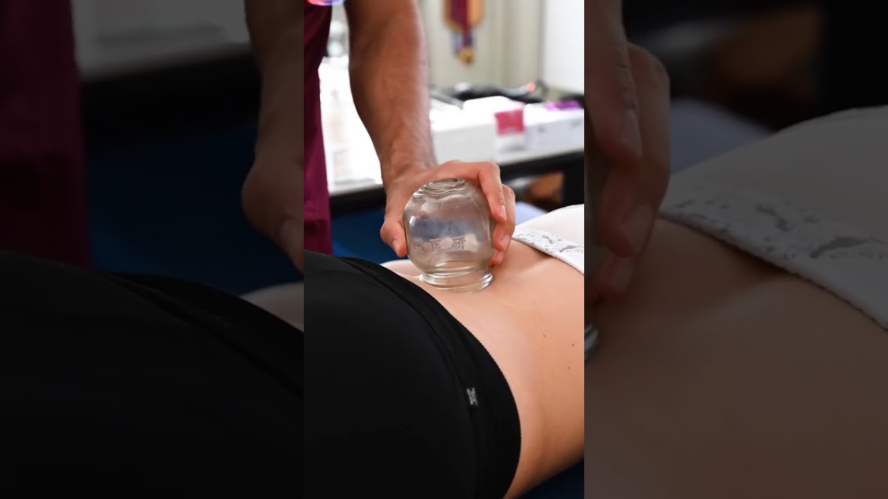 Giocando con il 🔥😜 conosci la coppettazione? Una tecnica antica della medicina cinese🧧