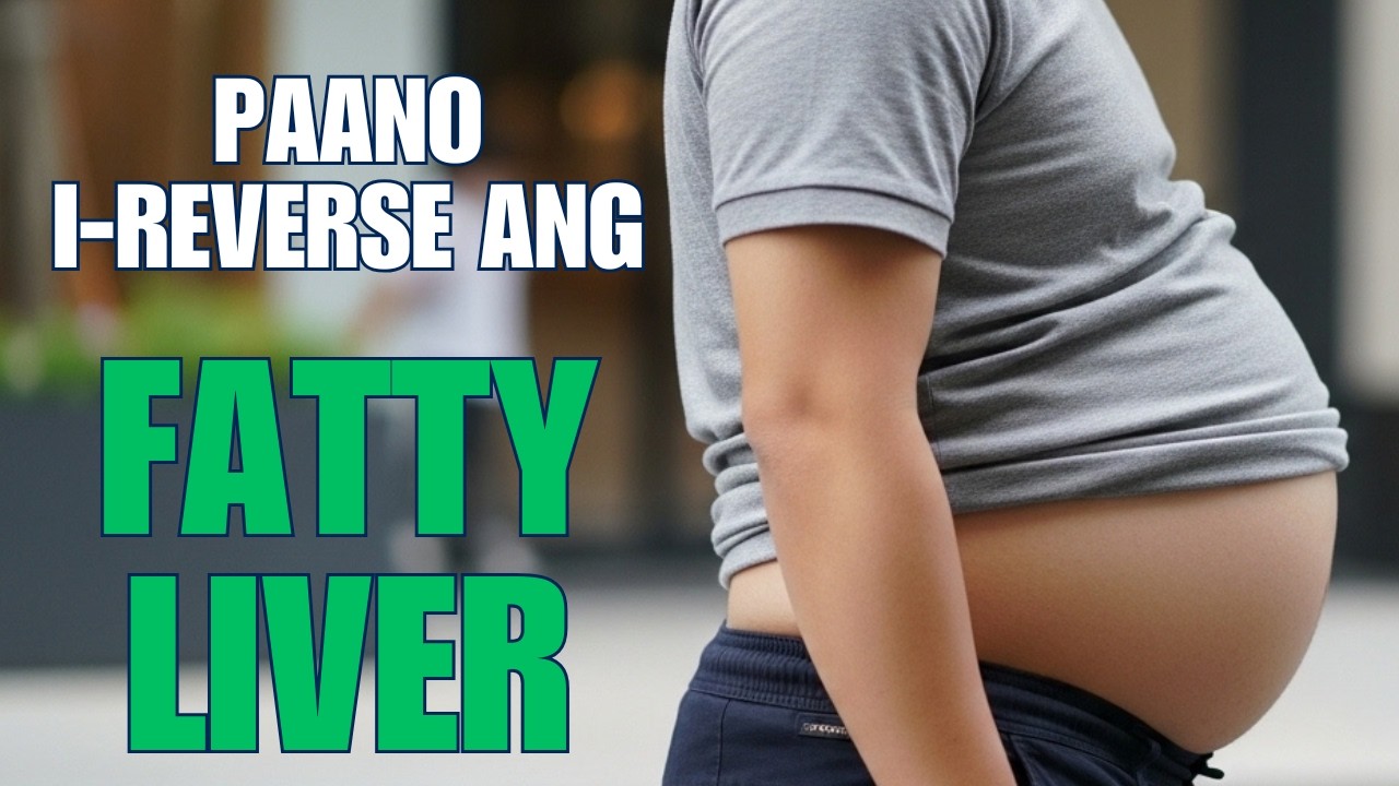 Fatty Liver: Paano Ito Naging Silent Killer at Paano I-reverse ang Early Stages