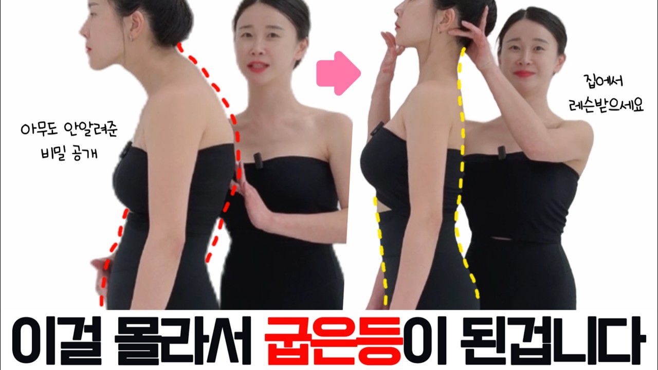 [딱10분🔥] 99%가 모르는 굽은등 펴는 방법, “이것”만 하면 거짓말처럼 등과 목이 세워집니다 | 굽은등교정 버섯목증후근 거북목 일자목
