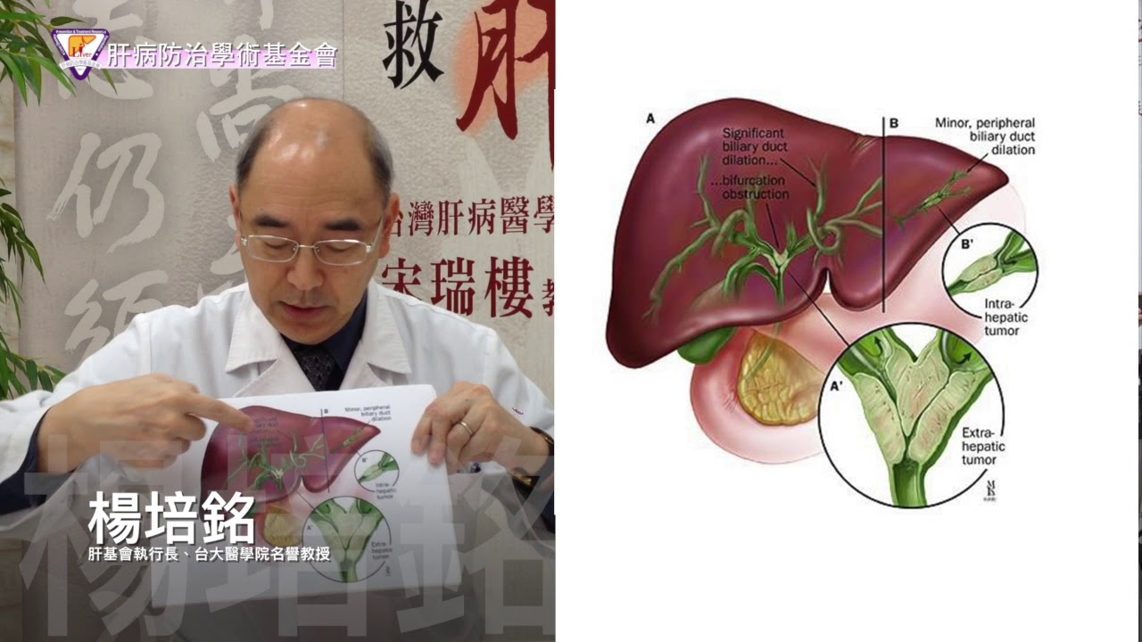 楊培銘／細談膽管細胞癌