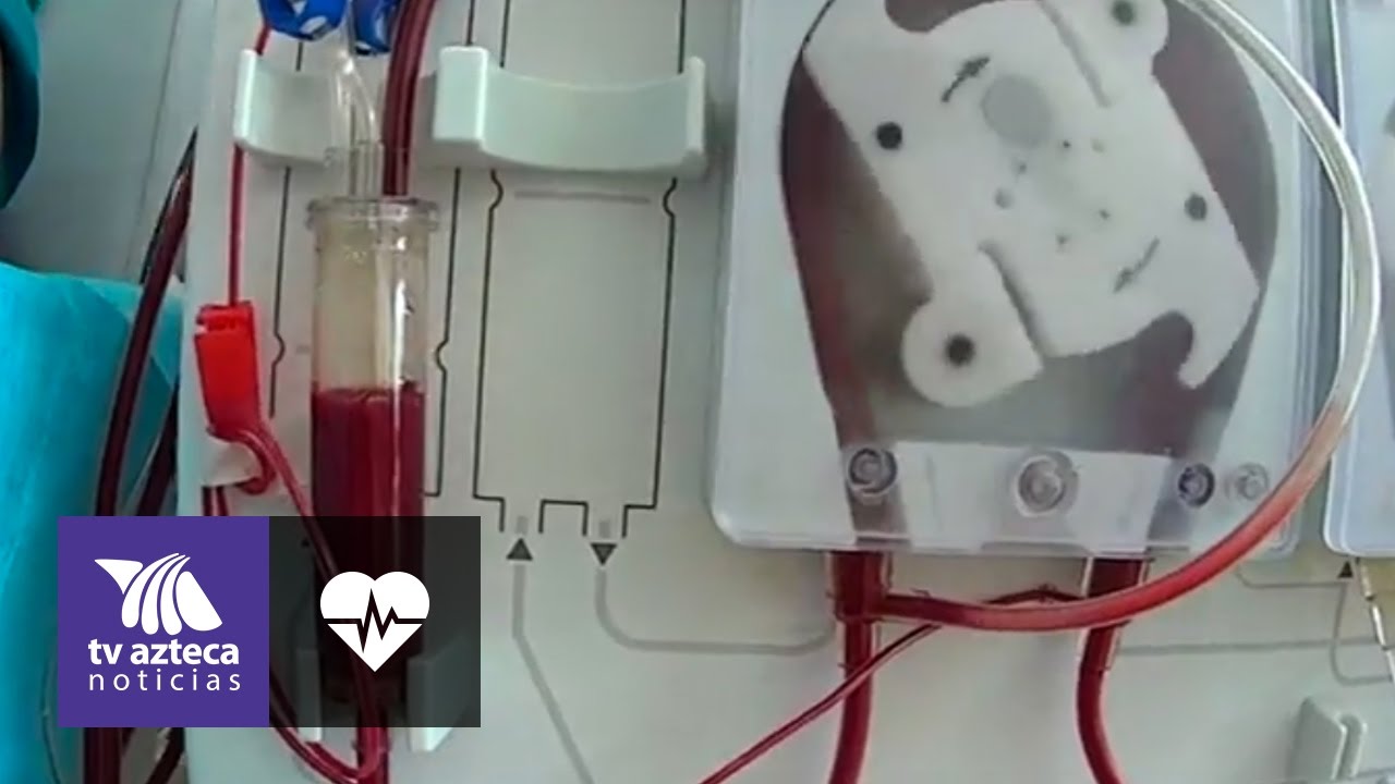 Novedosa máquina de hemodiálisis ayuda también a limpiar la sangre