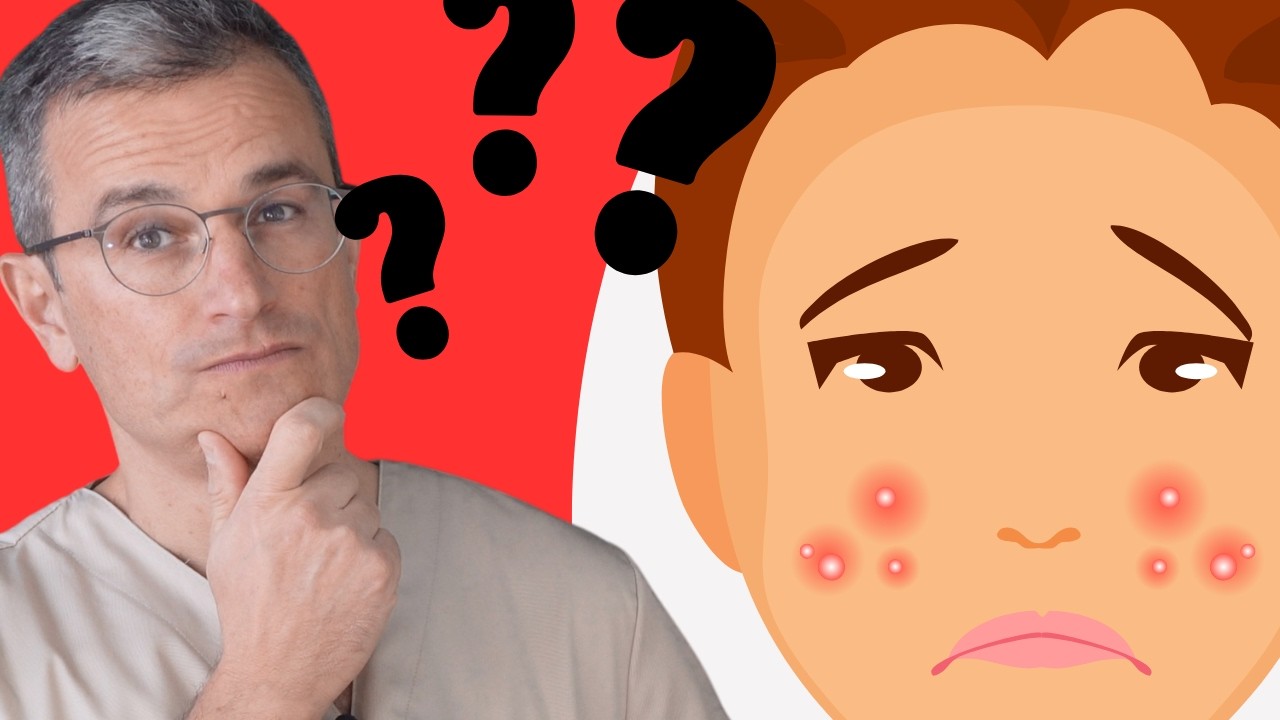 Akne loswerden: Selgamis vs. Epiduo Forte: Welches Akne-Medikament ist besser?
