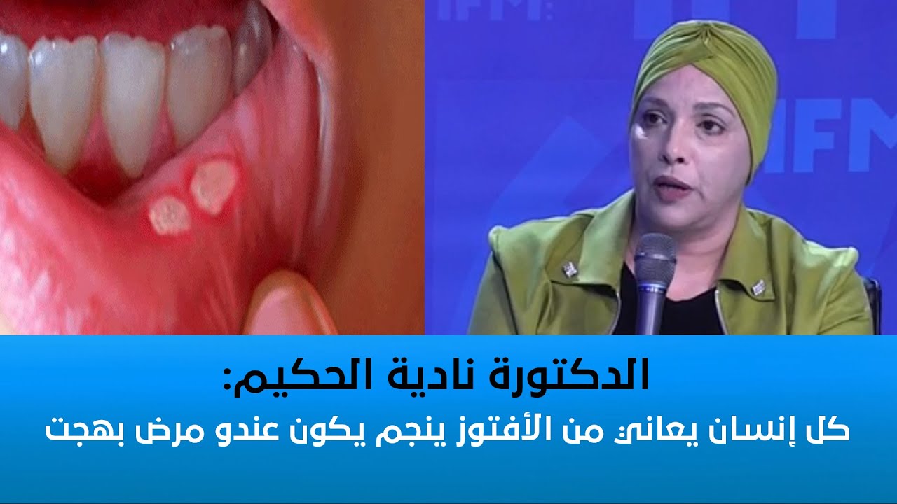 الدكتورة نادية الحكيم:  كل إنسان يعاني من الأفتوز ينجم يكون عندو مرض بهجت