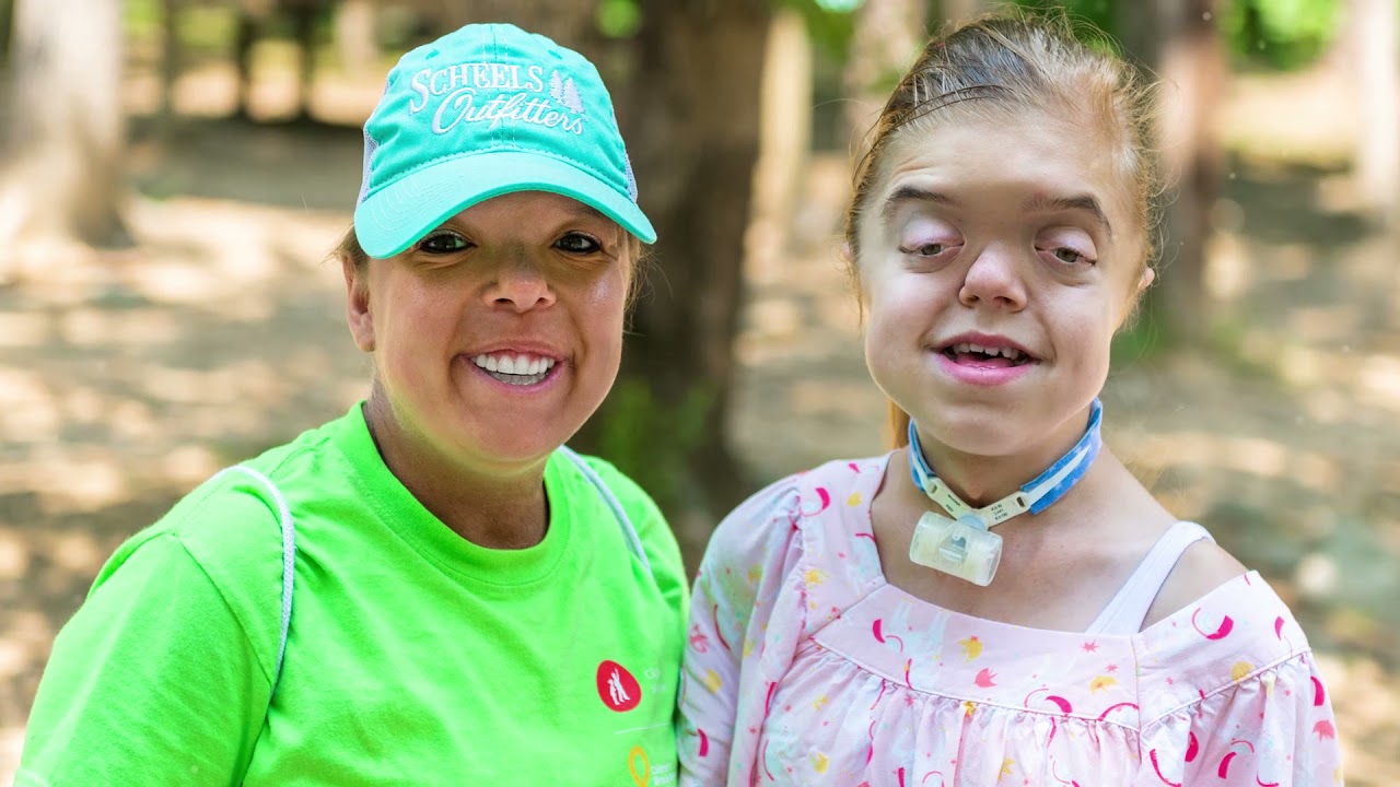 FACES Camp - A Camp for Kids with Facial Differences