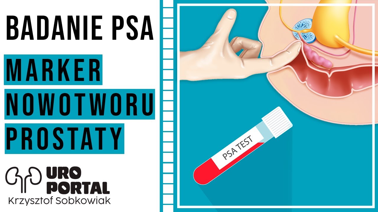 Prostata u mężczyzn - Badanie PSA. Rozrost gruczołu krokowego i rak prostaty - diagnostyka