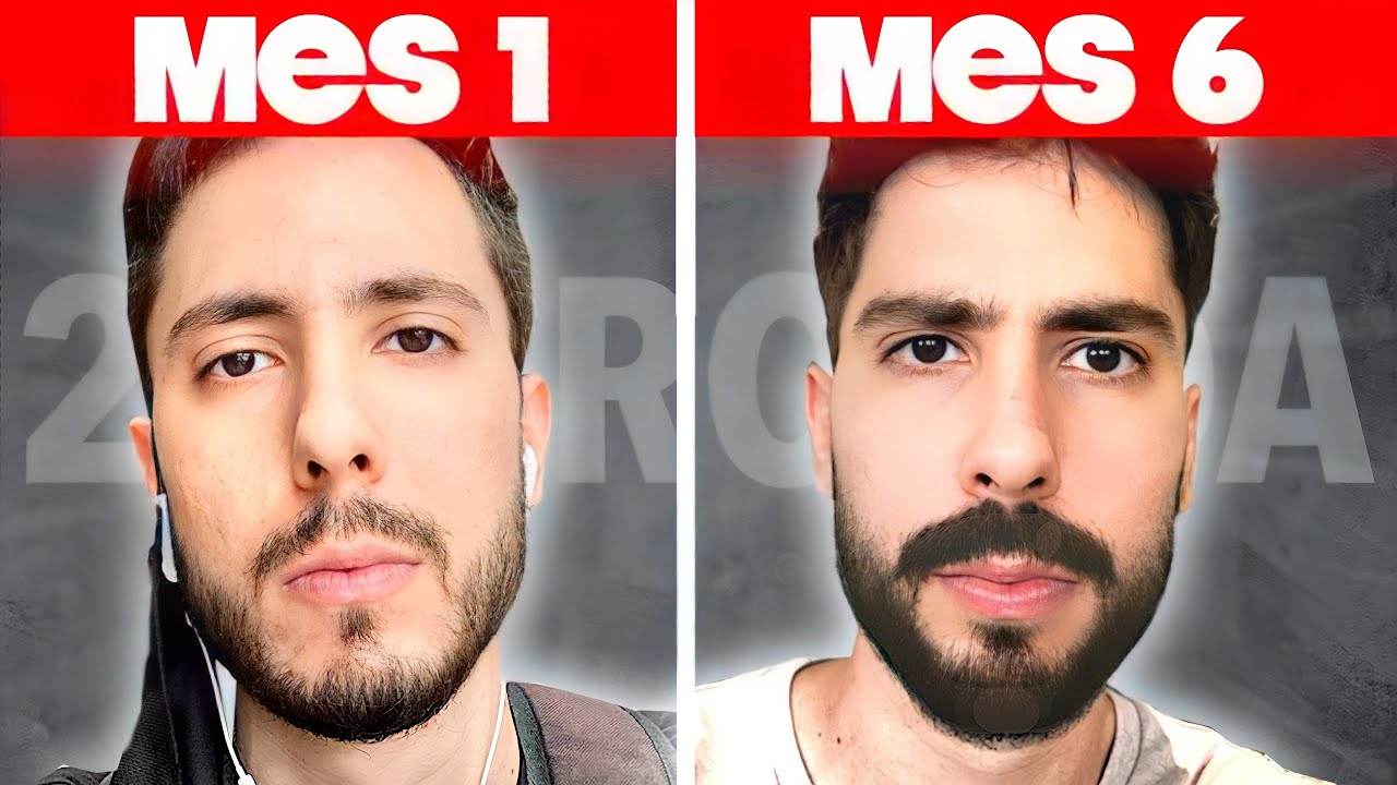 No Me Gustaba Mi Barba Así Que Utilicé Minoxidil Por 6 Meses