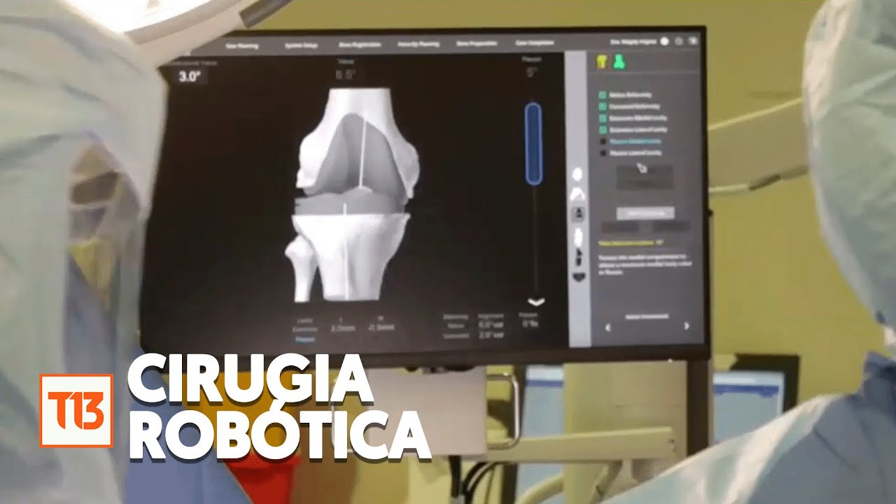 Inédita cirugía robótica en Hospital Sótero del Río.