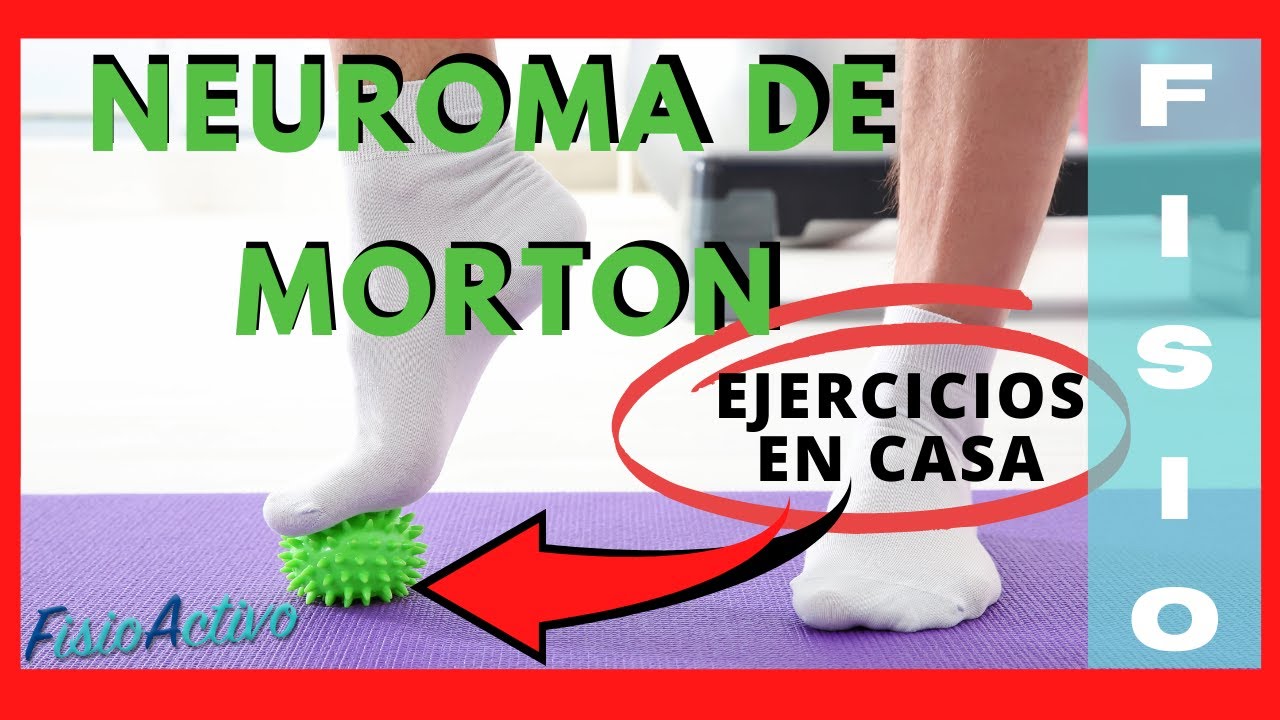 5 CLAVES para el Tratamiento Natural del NEUROMA DE MORTON | Causas, Síntomas, Fisioterapia 2021