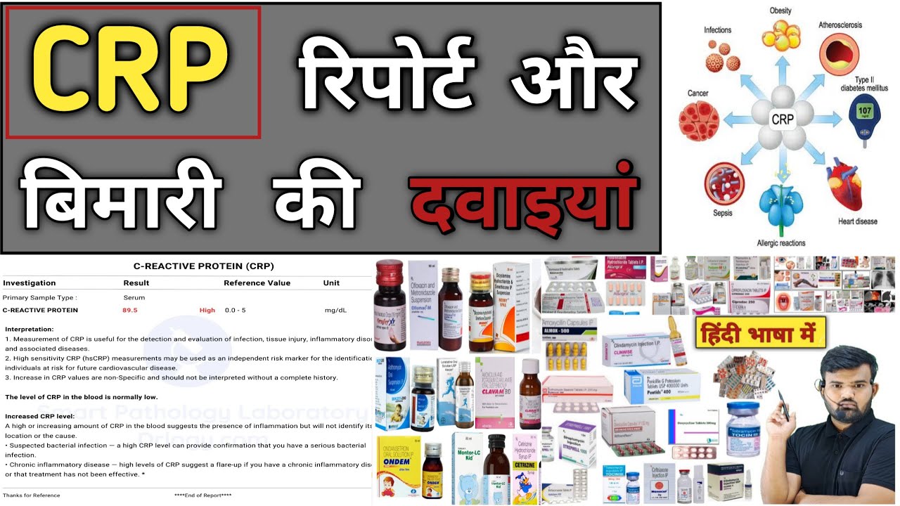 CRP रिपोर्ट | CRP Report | Medicine | Treatment | Doctor | Pharmacy | BHMS | Nursing | Medicine