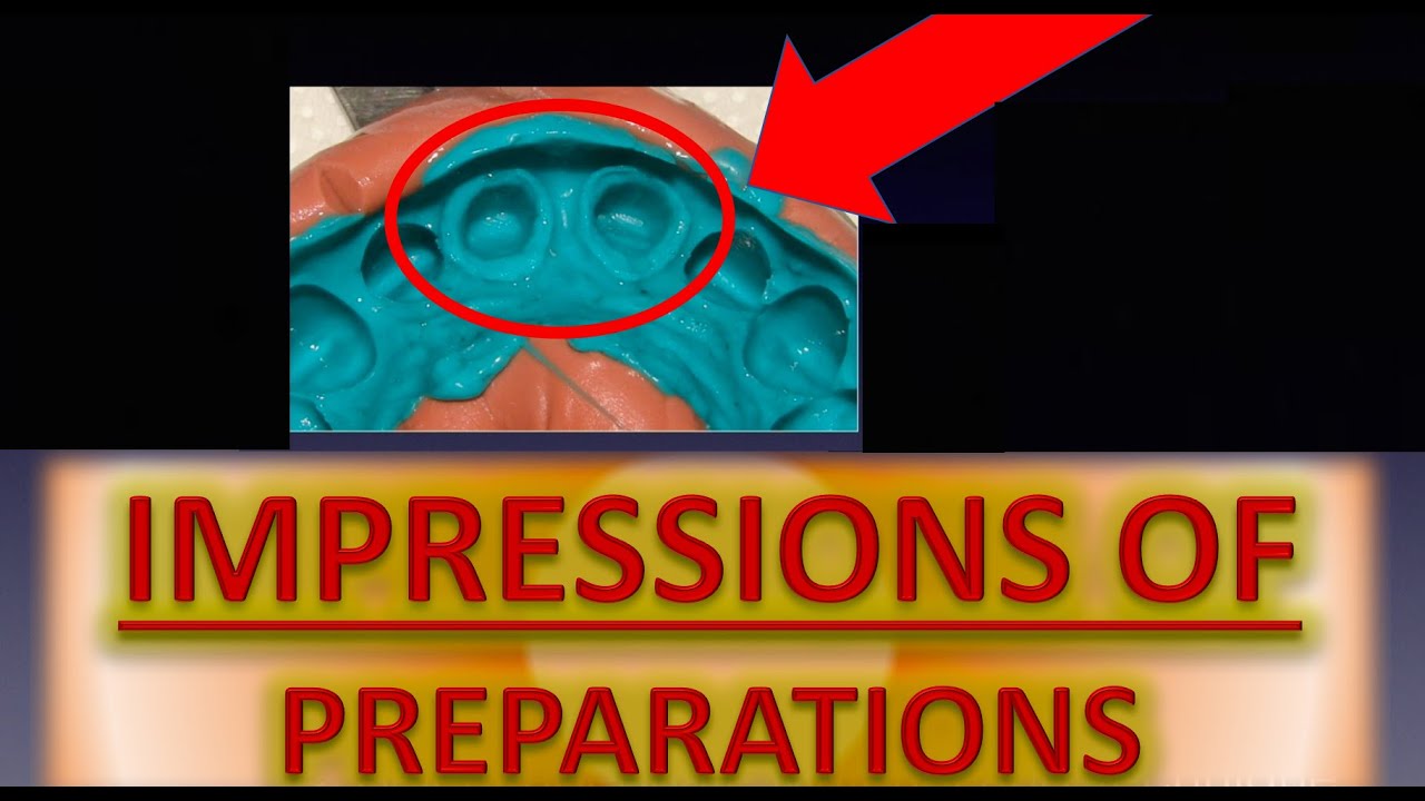 EASY Dental IMPRESSION of Crown PREPARATION: Tutorial (Addition Silicone, PVS, Polyether, putty)