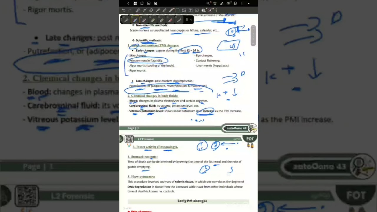 L2 Forensic : time of death & PM Changes P1 (FOT 43)