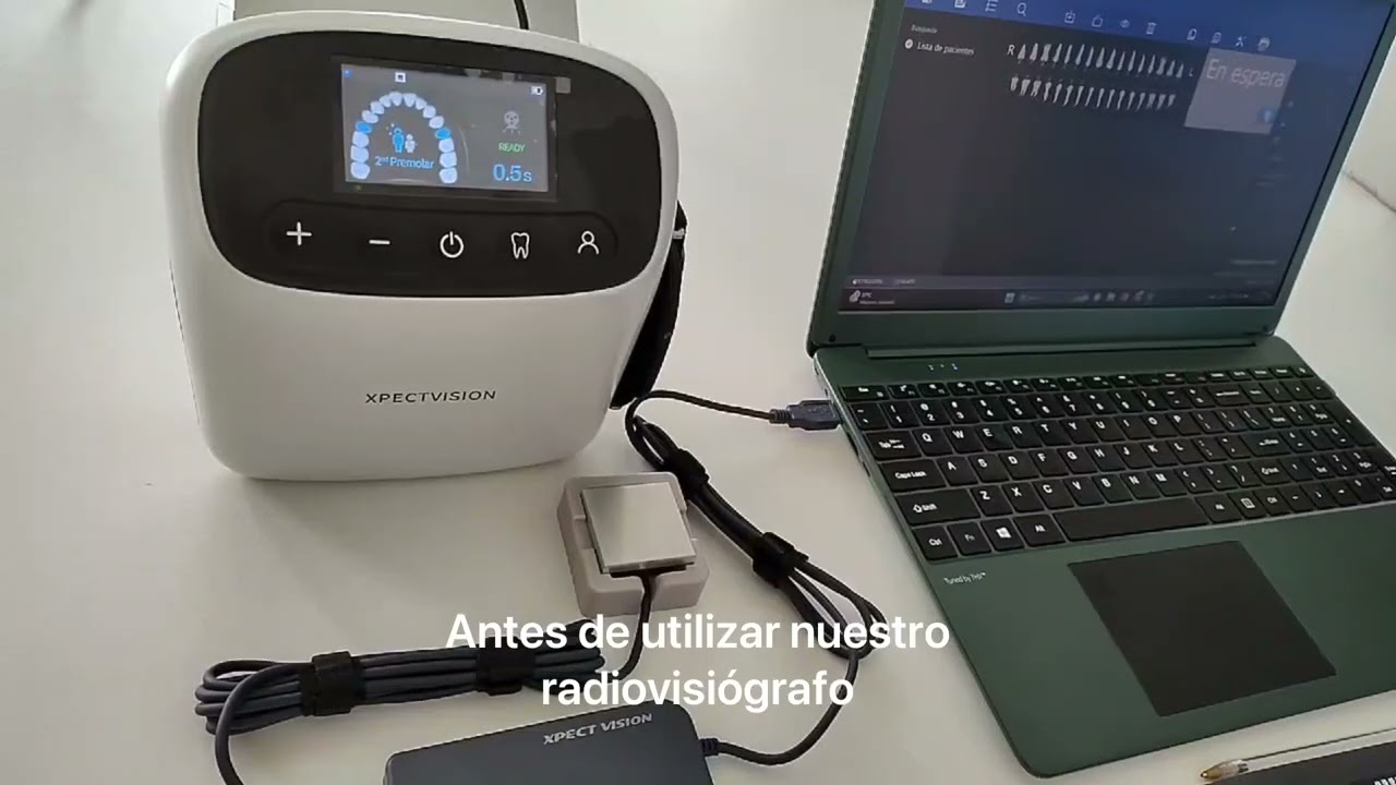 Tutorial Radiovisiógrafo Xpect Vision