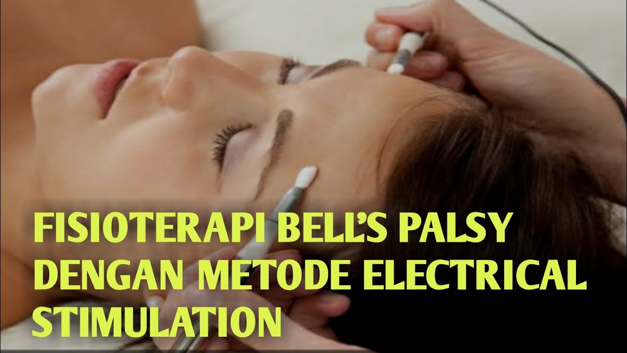 FISIOTERAPI BELL'S PALSY DENGAN METODE ELECTRICAL STIMULATION