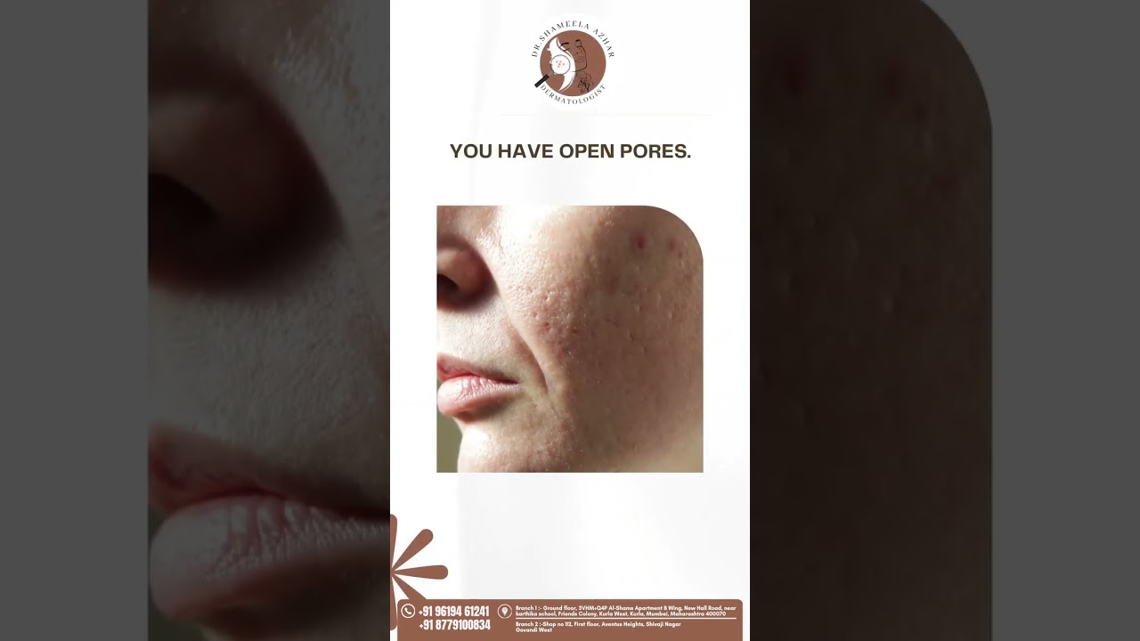 Healthy skin isn&rsquo;t about filters, it&rsquo;s about care #MNRF #SkinRejuvenation #dermatologycare