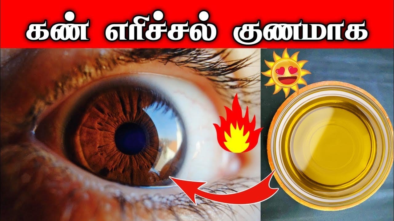 கண் எரிச்சல் குணமாக | How to cure eye irritation in tamil |Dr.Rajalakshmi | TCH