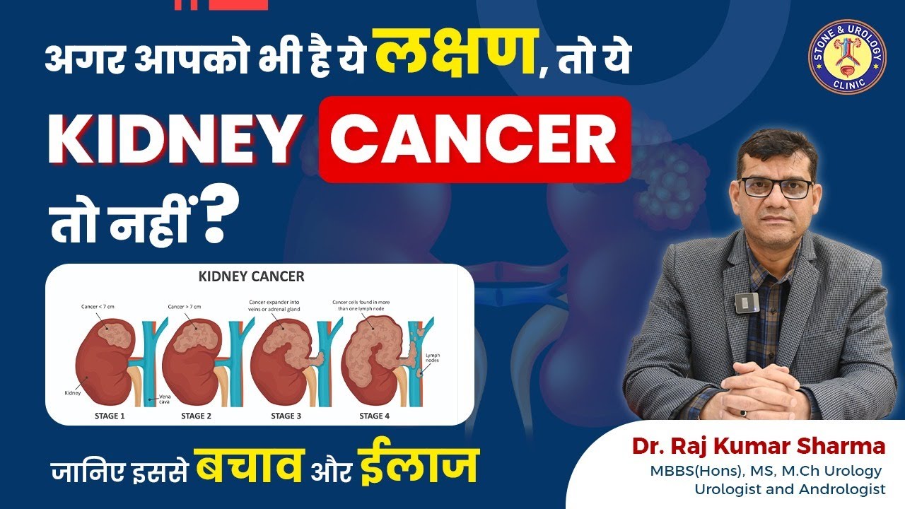 Kidney Cancer | किडनी कैंसर क्या होता है? |  Best Urologist | Dr. Raj Kumar Sharma | Ranchi |