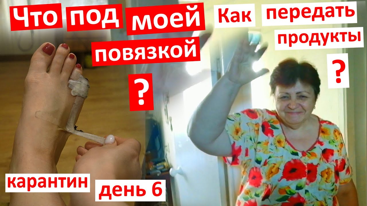 Карантин День 6. Что под моей повязкой? Как передать бабушке продукты? Покажу киевские улицы.