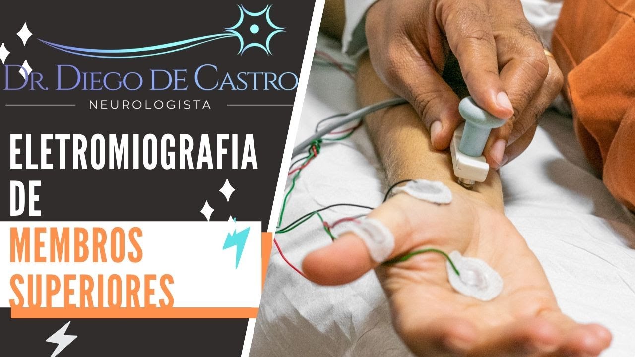 Eletroneuromiografia dos Membros Superiores MMSS | Dr Diego de Castro Neurologista