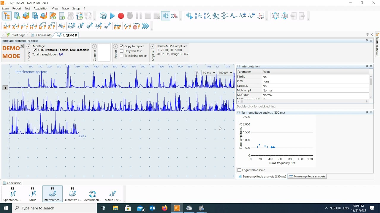 How to calculate RMS in Neurosoft EMG software
