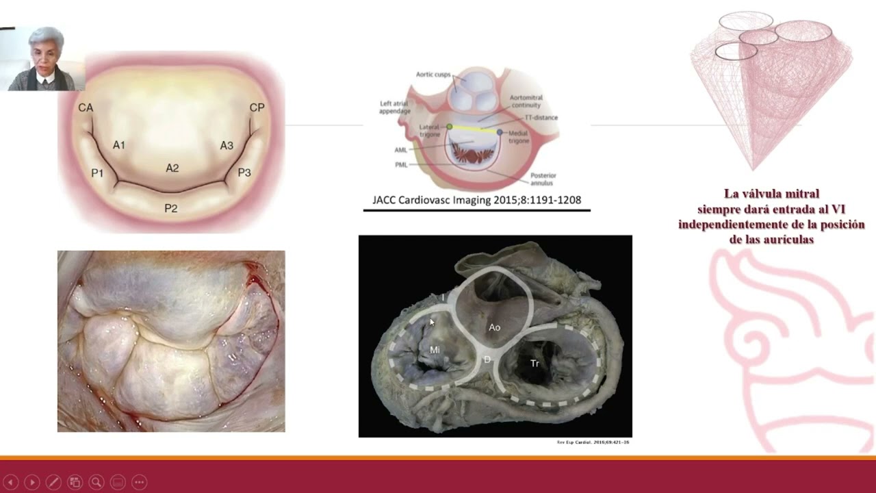 7. Válvula Mitral