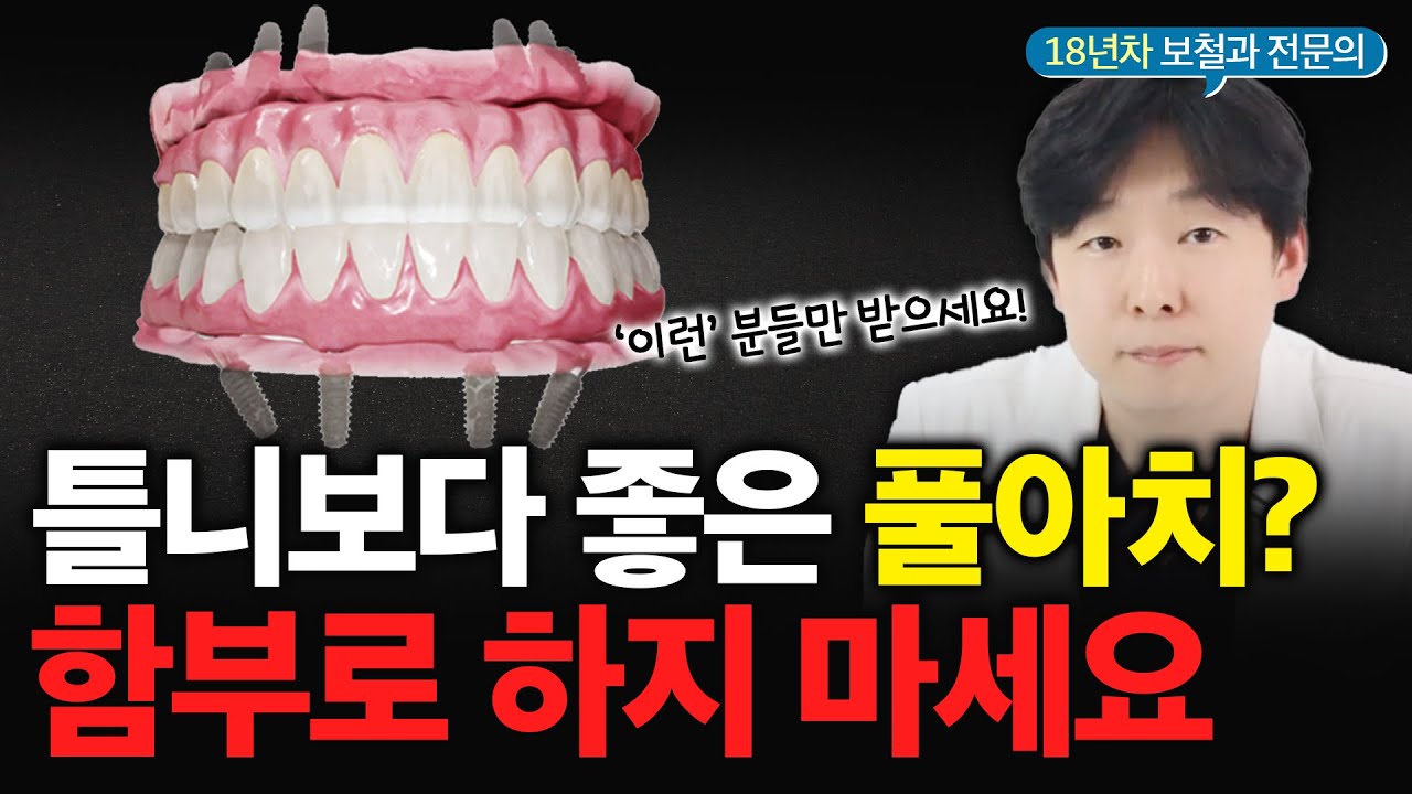 풀아치 임플란트 함부로 하면 안되는 이유