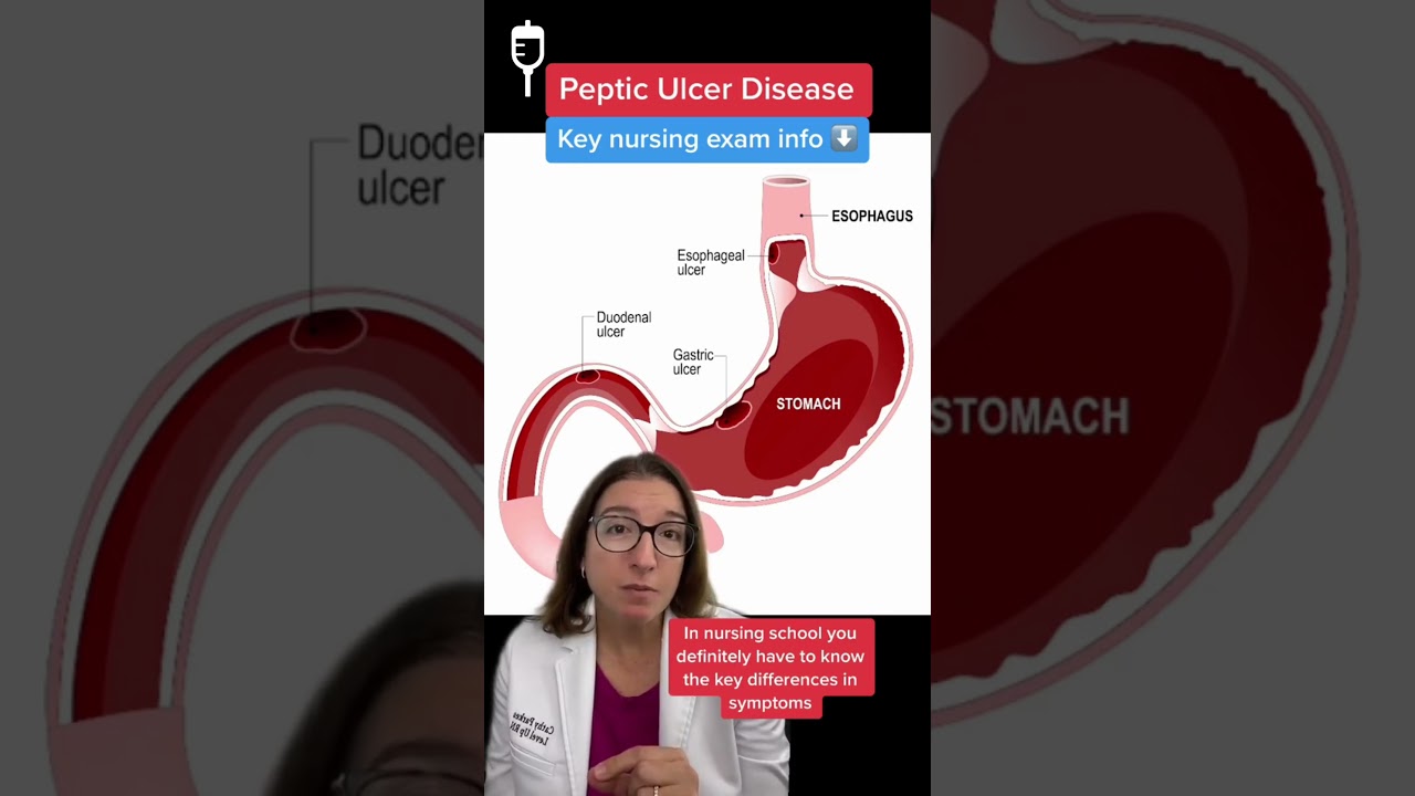 Peptic Ulcers: Medical Surgical SHORT | @LevelUpRN